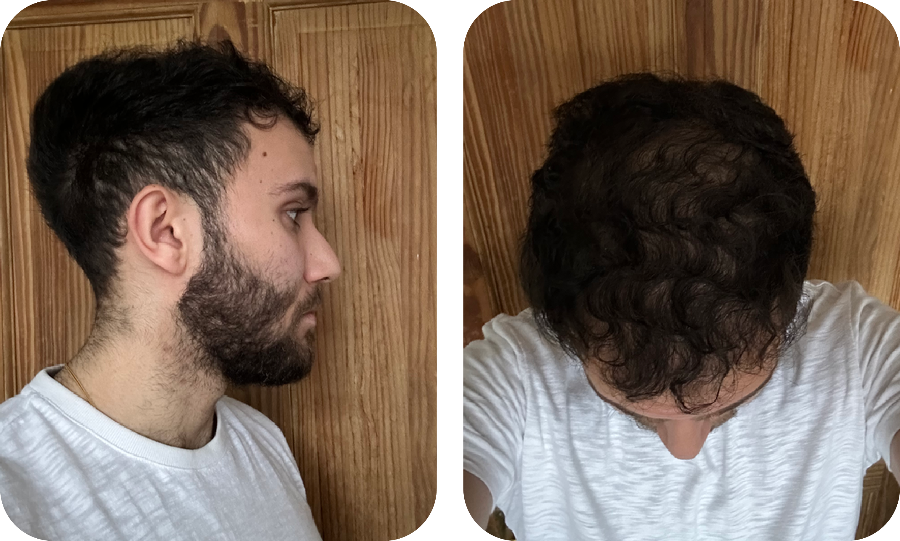 travis-hair